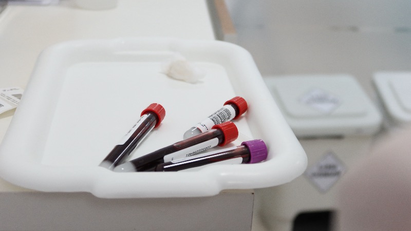 Nordic Countries Secretly Test People’s Blood For Previous Alcohol Use, Get Them Fired