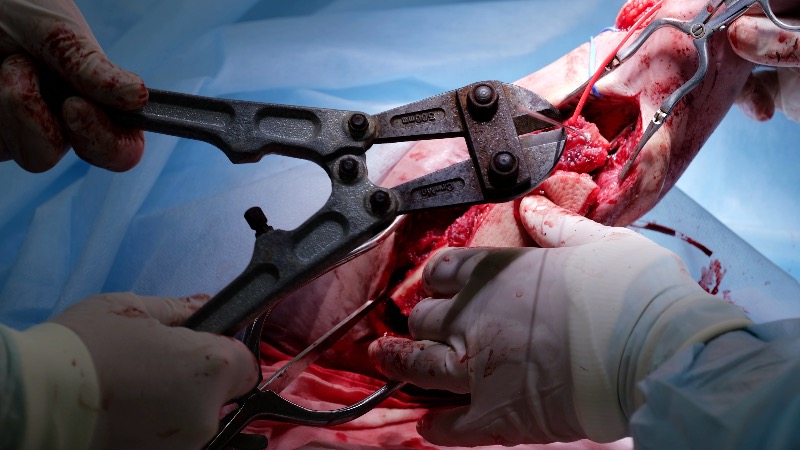 DOJ Subpoenas Over 20 Doctors & Facilities That Chopped Off Children’s Private Parts