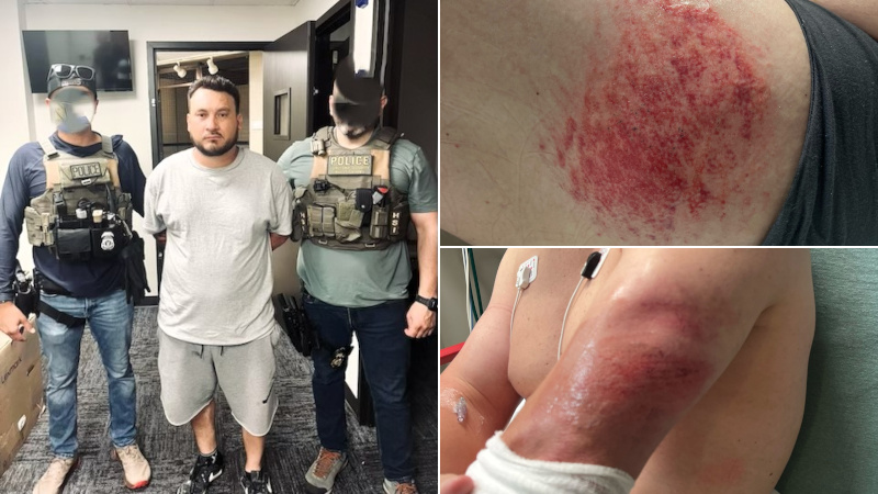 ICE Officer Injured When Fleeing Illegal Drags Him Down Road
