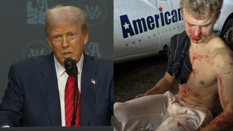 Big Balls Attacked? ‘DOGE Team Member’ Beaten Bloody by Mob of Teen Thugs, Trump Calls to Federalize D.C. Following Assault