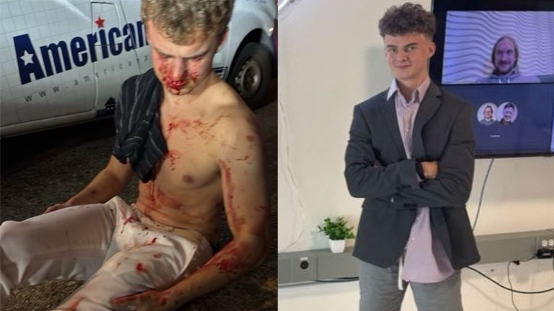 Two 15-Year-Olds Arrested in Connection With Beating of DOGE Team’s ‘Big Balls’