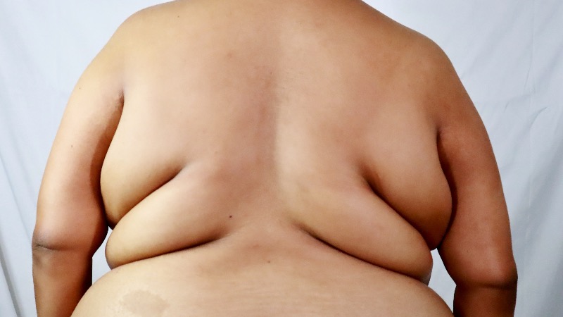 Trump State Dept. Says US Visas Can Now Be Denied To Unhealthy, Fat Foreigners