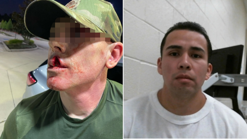 ICE Agent Viciously Attacked by Illegal Alien Pedophile