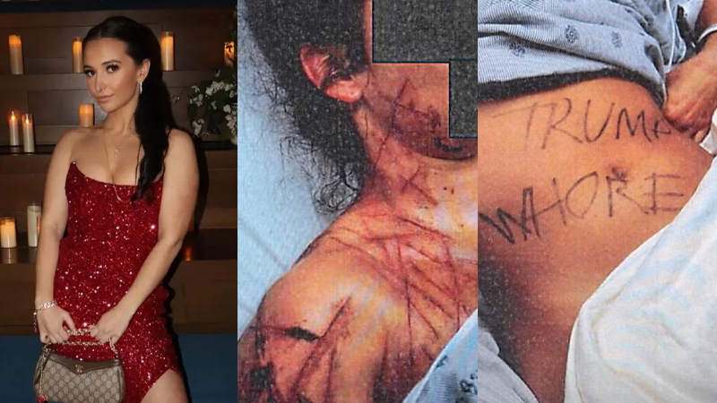 Hate Crime Hoax: Former House GOP Aide Accused of Staging Anti-Trump Assault With Help of Fetish Artist