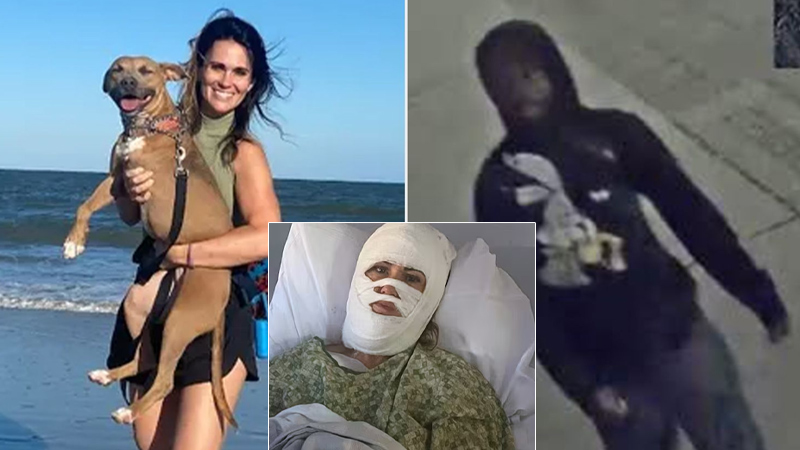 Georgia Woman Leaving Church Xmas Event Suffers Severe Burns to Face, Body After Random Attack With Toxic Chemical While Walking At Park