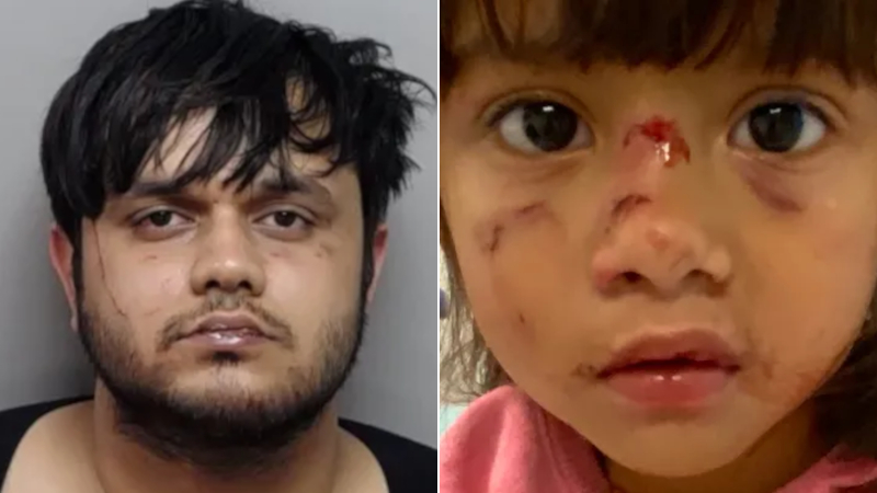 UPDATE: Suspect Arrested for Biting Toddler’s Face During ‘Zombie’ Attack in Texas Is an Illegal Alien From India
